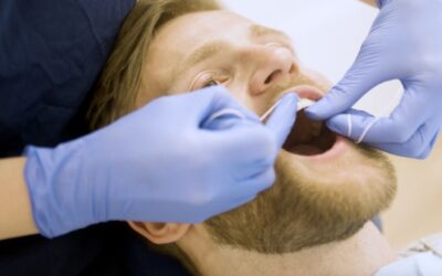 Tannstein: Hva det er, hvorfor du får det og hvordan det fjernes